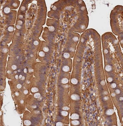 ARHGAP17 Antibody