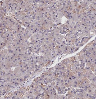 ARHGAP17 Antibody