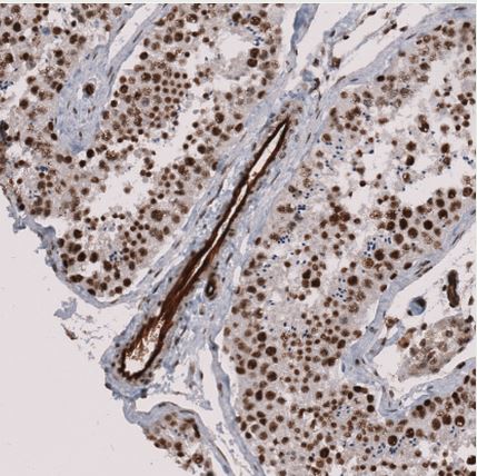 MMRN2 Antibody