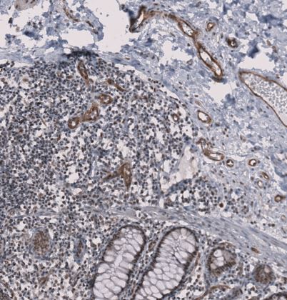 MMRN2 Antibody
