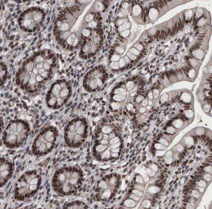 DMTF1 Antibody
