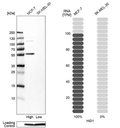 HID1 Antibody - BSA Free Immunohistochemistry-Paraffin: HID1 Antibody - BSA Free [NBP1-84075]