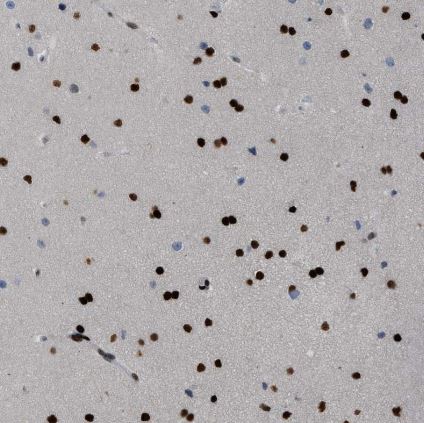 ZBTB20 Antibody