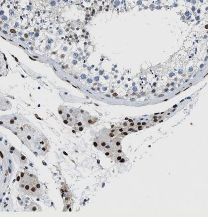 ZBTB20 Antibody
