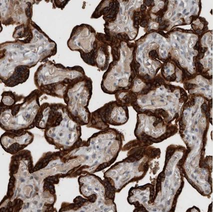 YOD1 Antibody