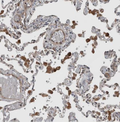 YOD1 Antibody