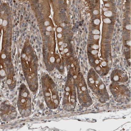 YOD1 Antibody