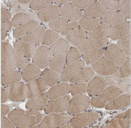 YOD1 Antibody