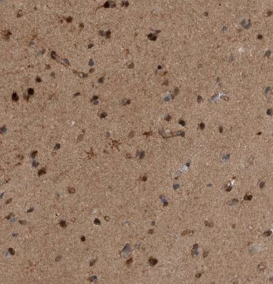 RAB3GAP2 Antibody