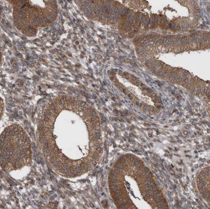 RAB3GAP2 Antibody