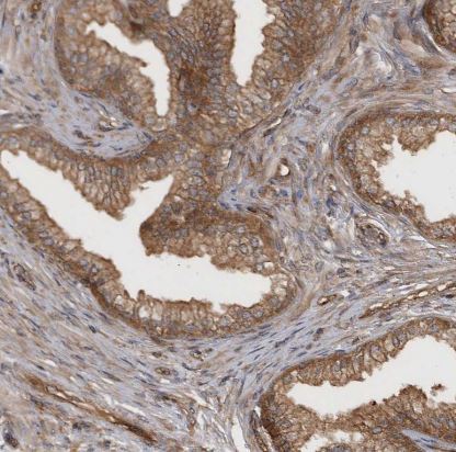 RAB3GAP2 Antibody