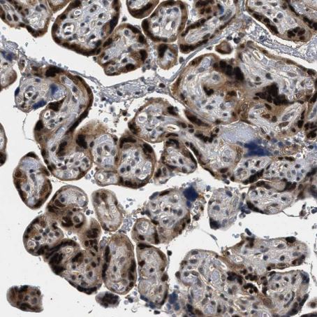 RBM33 Antibody