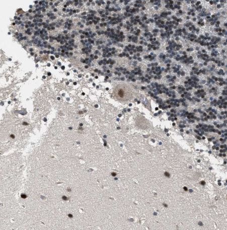 RBM33 Antibody