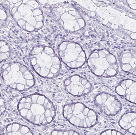 DEFA6 Antibody [NBP1-84281]