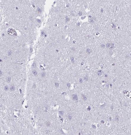 DEFA6 Antibody [NBP1-84281]
