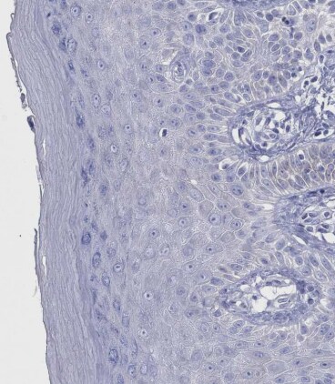 CRYGS Antibody