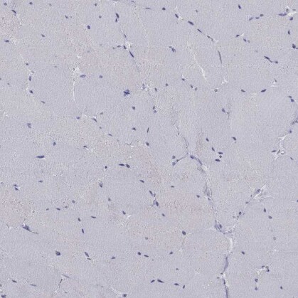 CRYGS Antibody