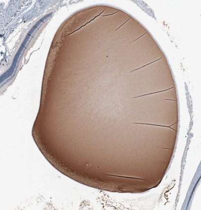 CRYGS Antibody