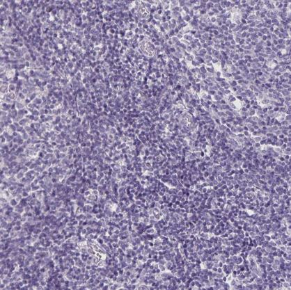 SH3GL3 Antibody