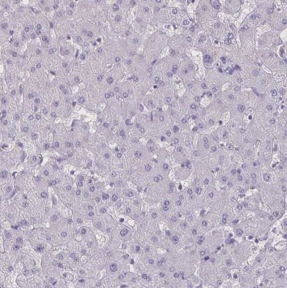 SH3GL3 Antibody