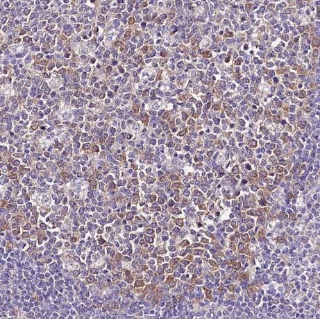 Abhd5 Antibody