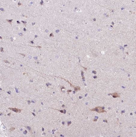 Abhd5 Antibody