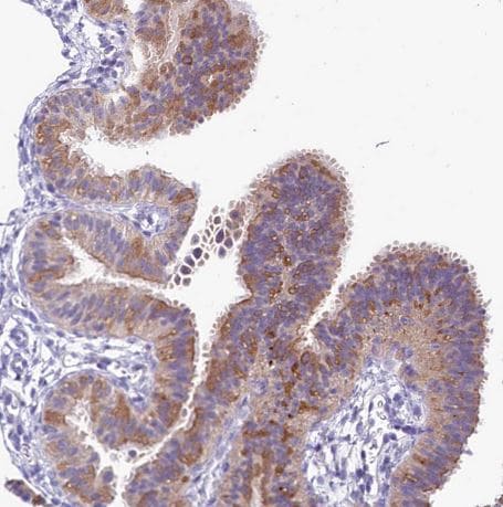 Abhd5 Antibody