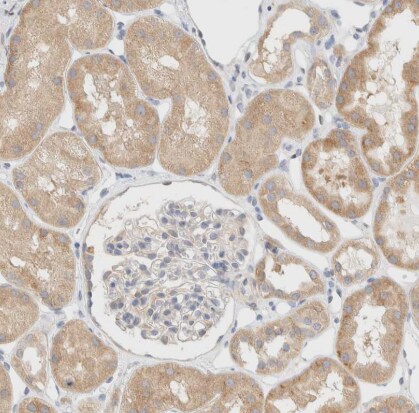 NT5C Antibody