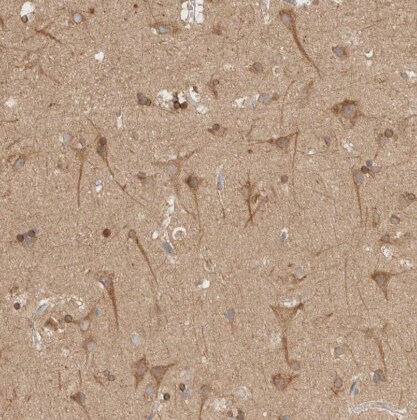 NT5C Antibody