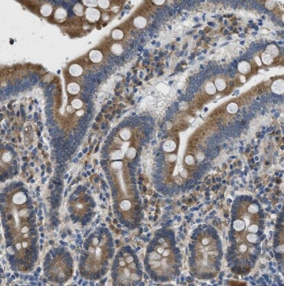 MPDU1 Antibody