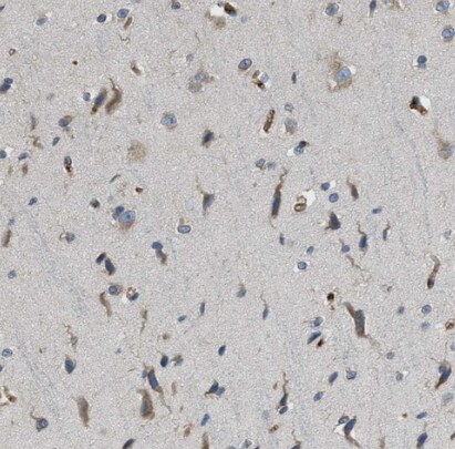 MPDU1 Antibody