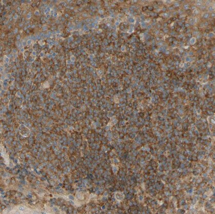 IKK gamma Antibody