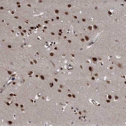 WBP4 Antibody