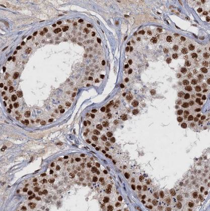 WBP4 Antibody