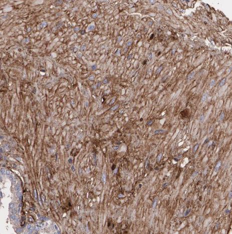 Fibulin 1 Antibody