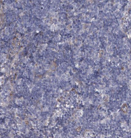 Fibulin 1 Antibody