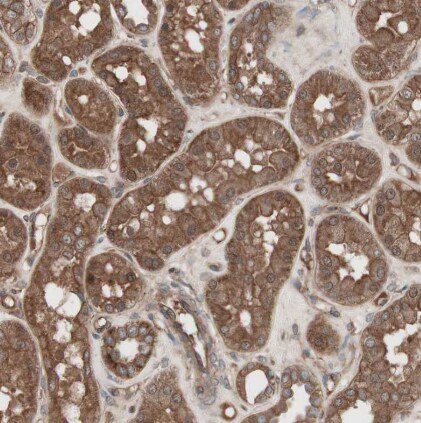 TFPI Antibody