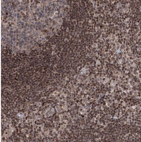 PHC3 Antibody