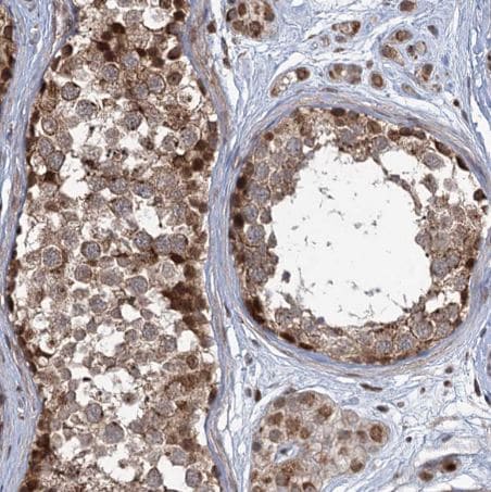 PHC3 Antibody
