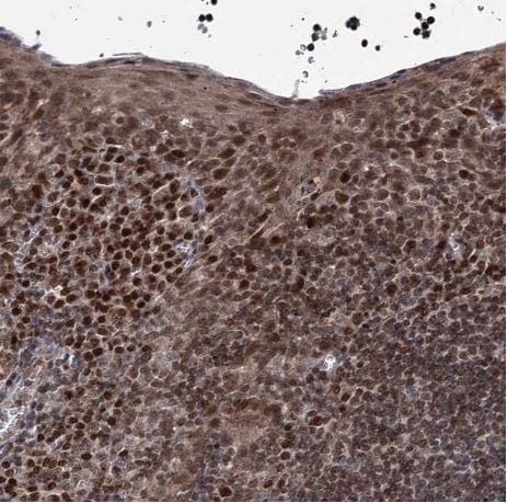 PHC3 Antibody