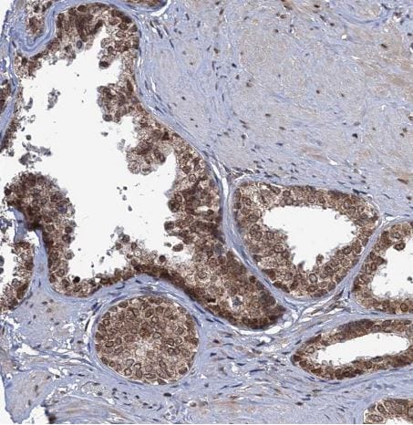 PHC3 Antibody