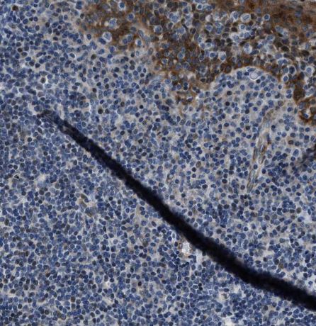 PHLDA1 Antibody