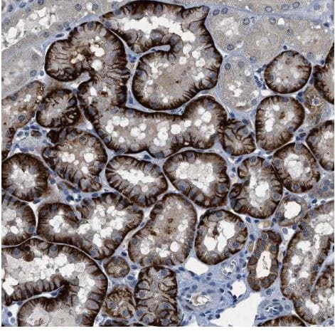 PHLDA1 Antibody