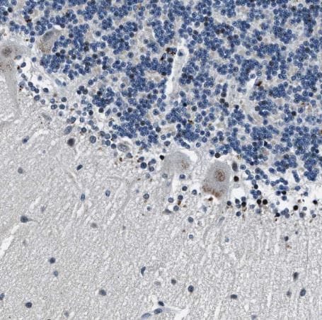 PHLDA1 Antibody