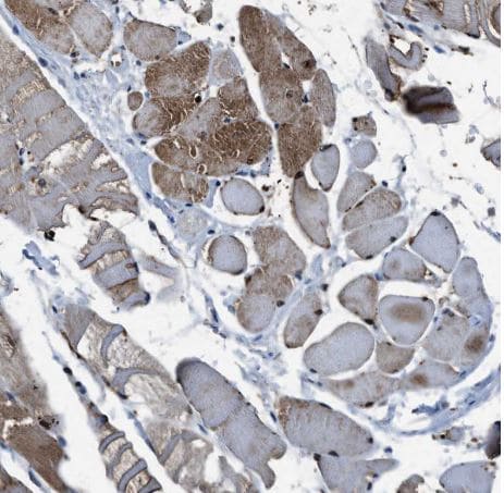 PHLDA1 Antibody
