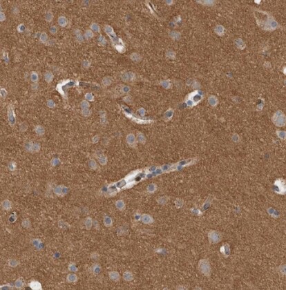Dematin Antibody - BSA Free