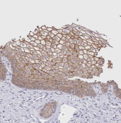 SLC39A10 Antibody