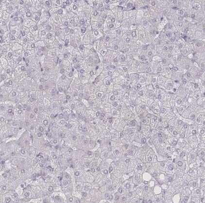 SLC39A10 Antibody