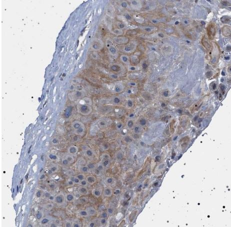 NAT9 Antibody