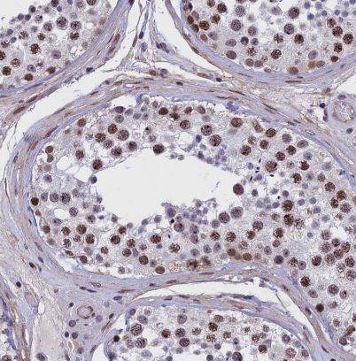 NIPBL Antibody